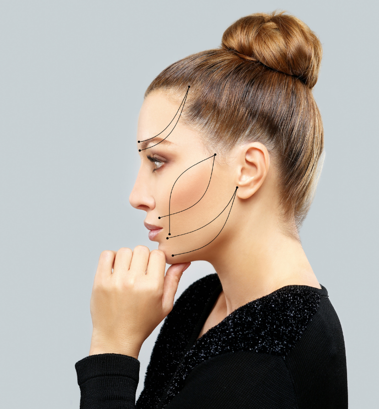 Thread Lift Treatment in Vadodara | Best Non-Surgical Face Lift & Lift Treatment