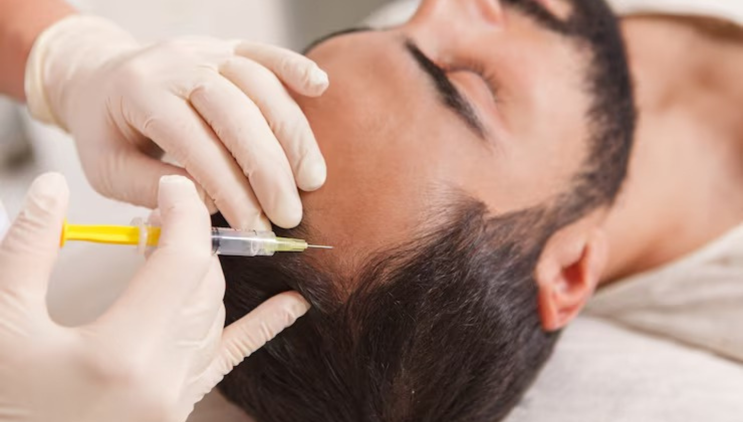 Hair Transplant Benefits - Why Restoring Your Hair Is an Investment in Your Best Self.png