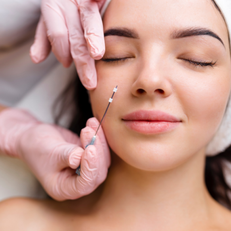 Thread Lift Treatment in Vadodara | Best Non-Surgical Face Lift & Lift Treatment